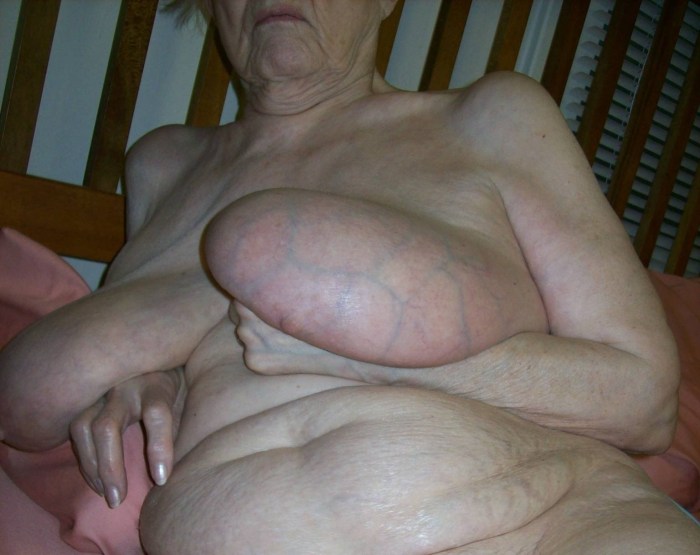 Old Wrinkled Tits Porn 23 Photos Sex Pics