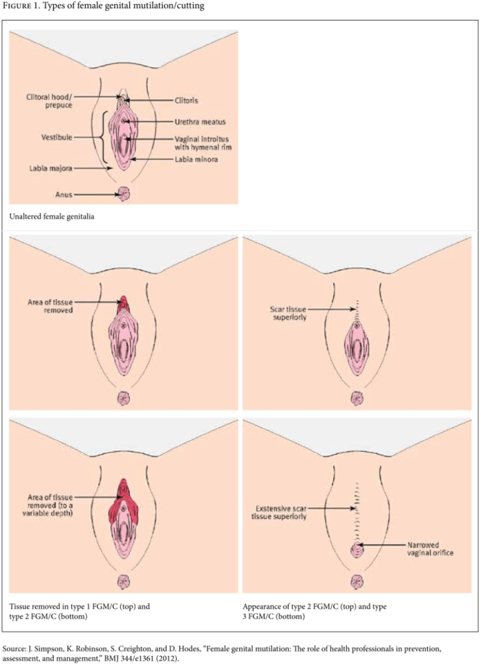 Porn Types Of Female Genitals 58 Photos Sex Pics