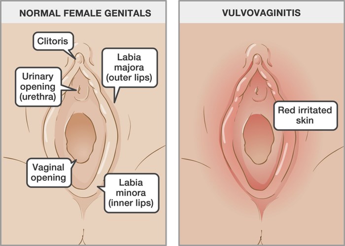 Porn Types Of Female Genitals 58 Photos Sex Pics