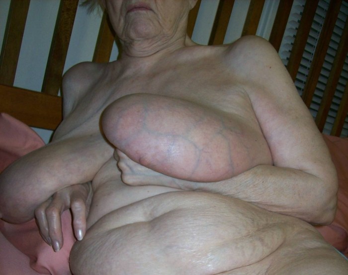 Naked old thick couples