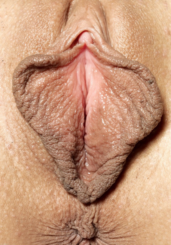The large clitoris is private