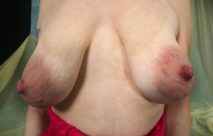 Daggering female breasts