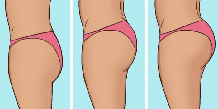 The correct shape of the buttocks