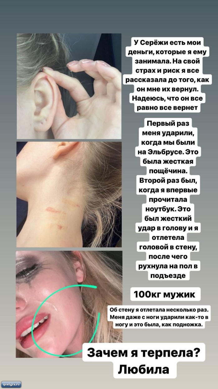 Milena Bezborodov’s legs