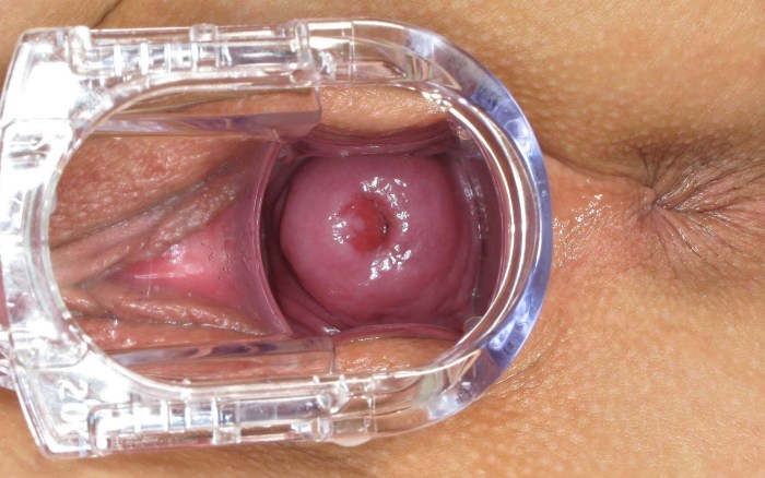 Women's vagina inside