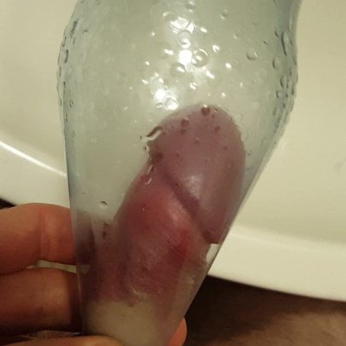 Anal fisting products