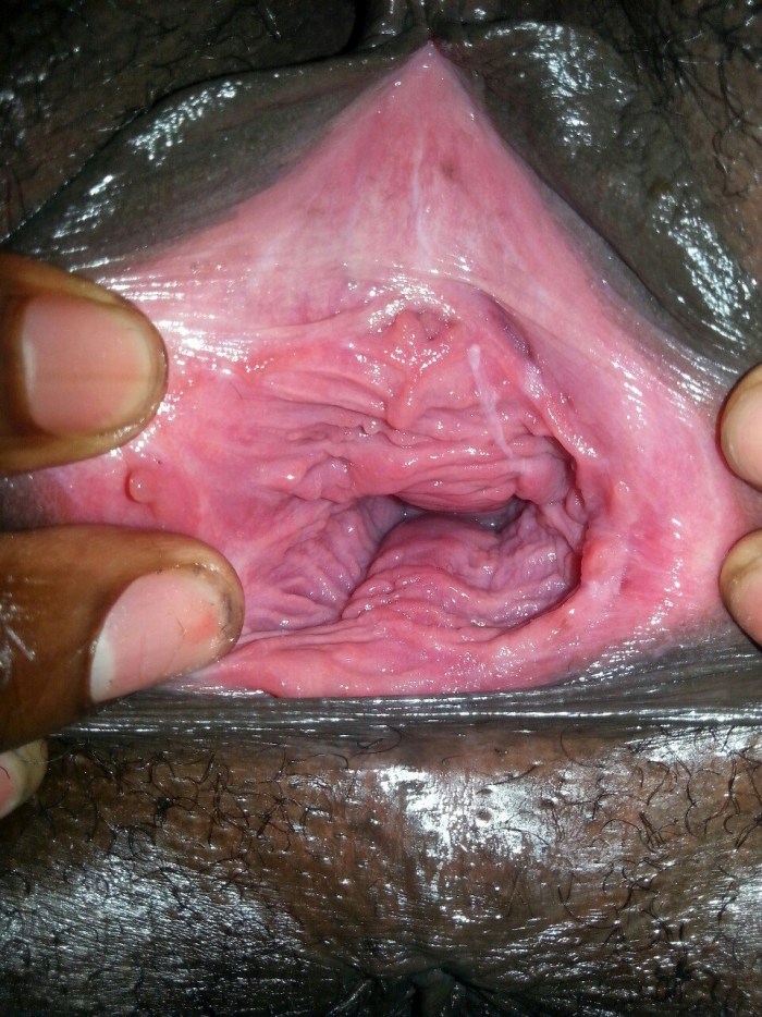 The insides of the vagina