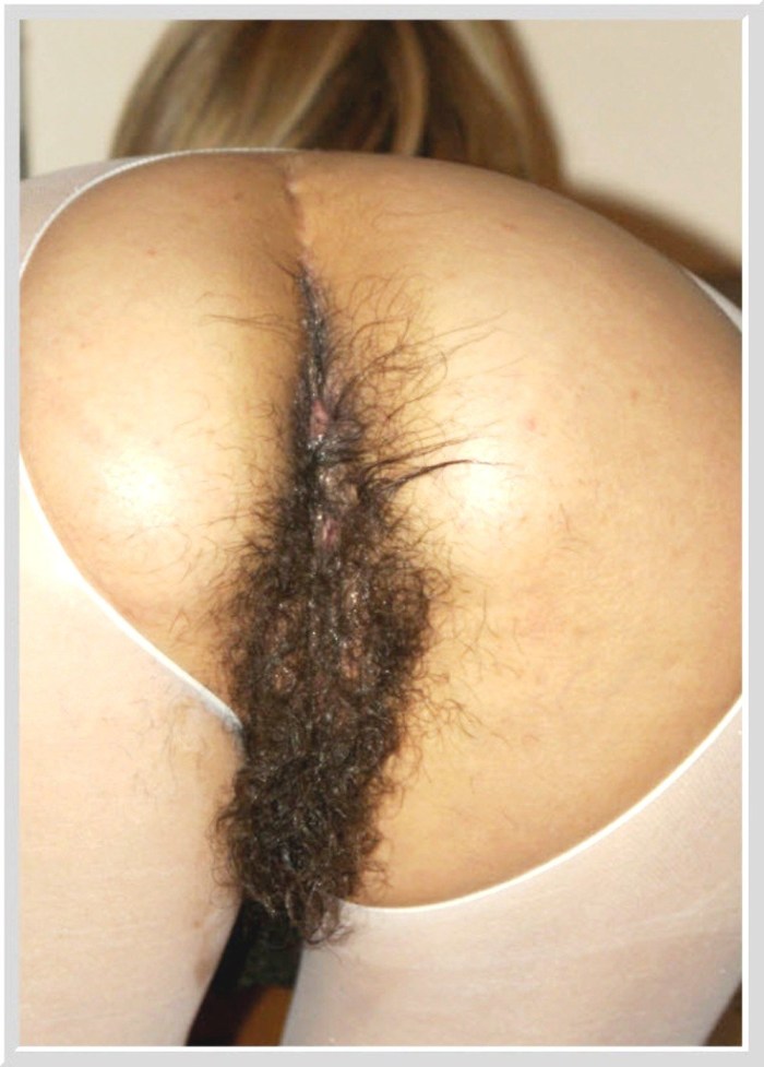 The hairy asses of girls