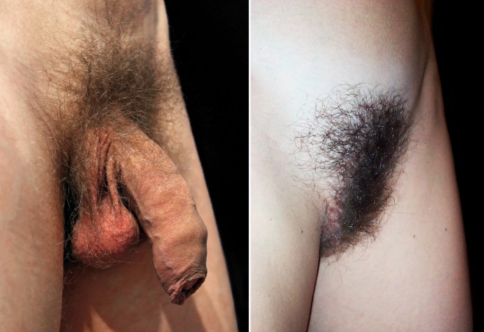 Hairy female genitals