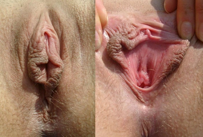 Beautiful genitals