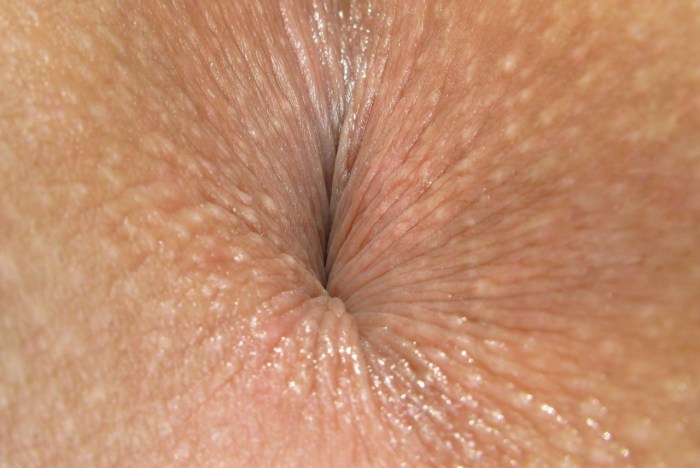 Anal holes of black women