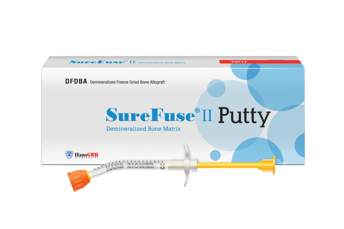 Aletta Ocean before surgery