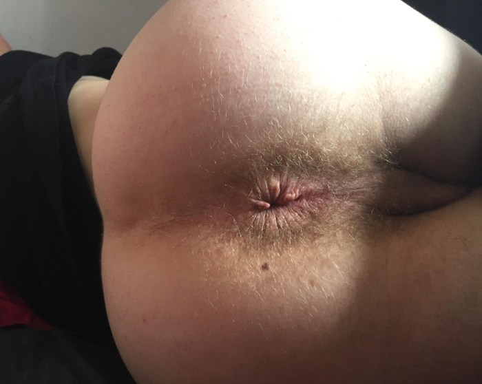 Was Anus