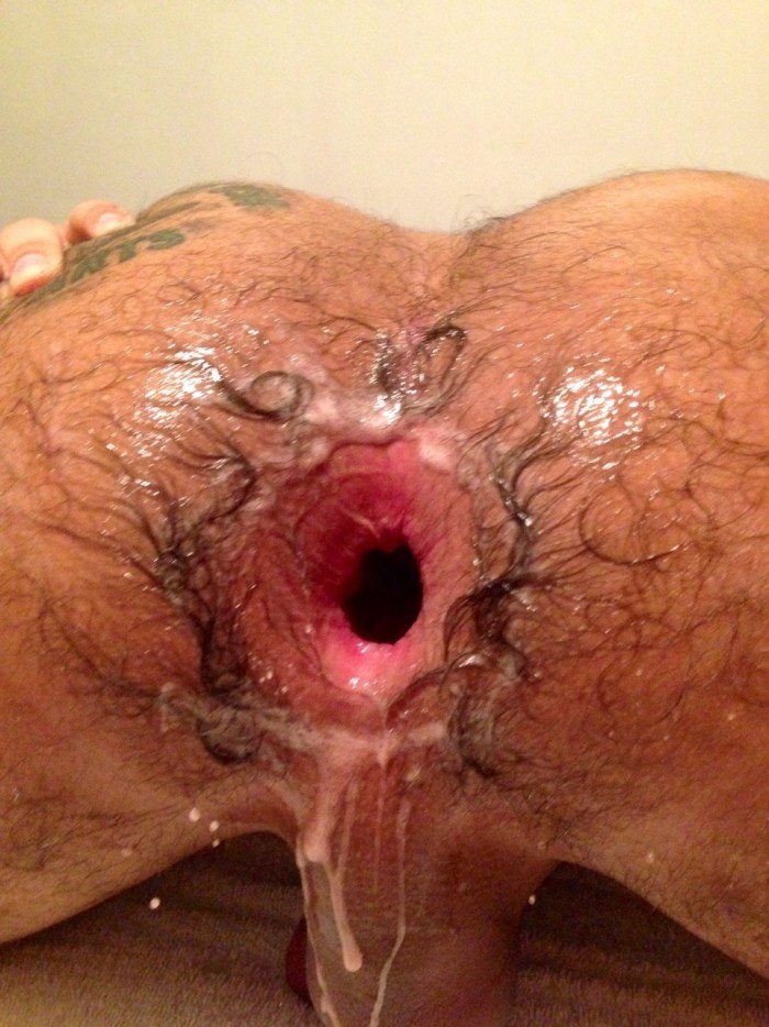 A torn anus