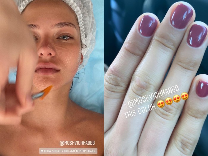 Olesya Kafelnikova Anorexia