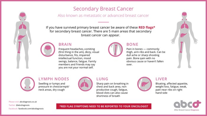 Marina Shimkovich breast
