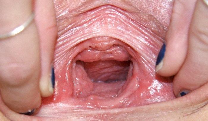 Women's vagina from the inside