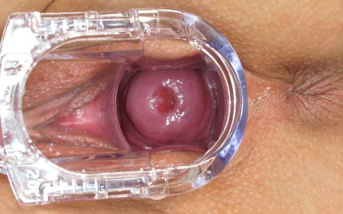 A video camera inside the vagina