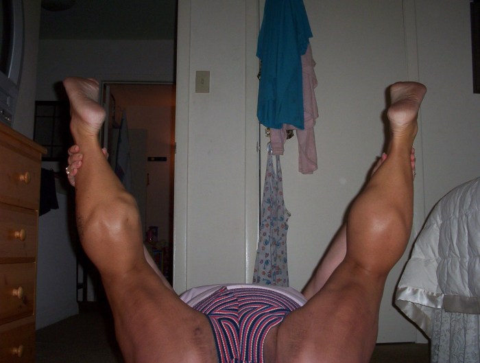 Calves Feet