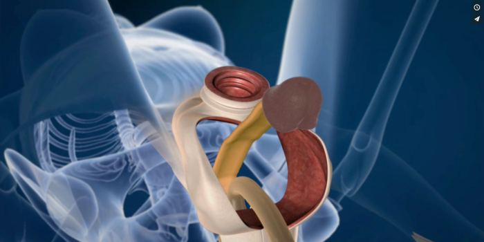 Operation for the change of sex organs