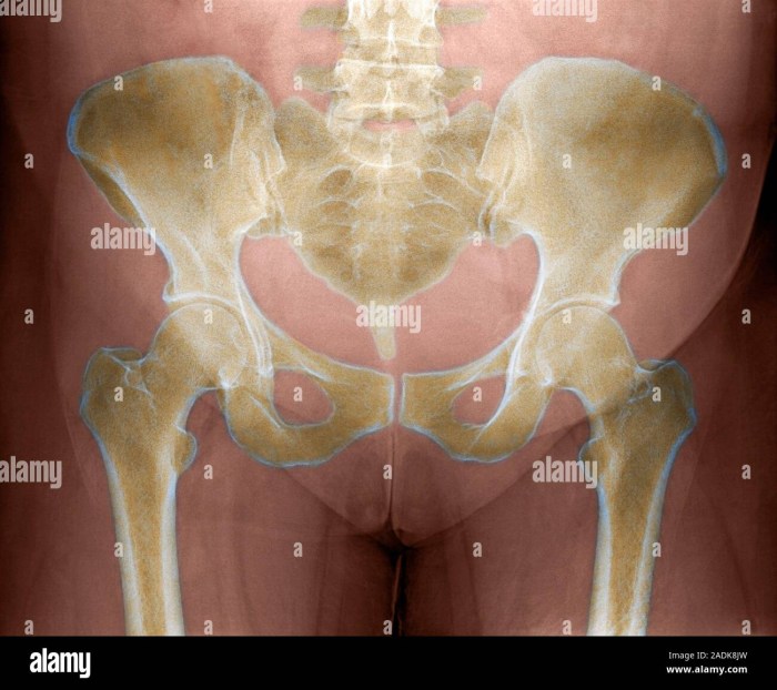 Anatomy of Almiola feels