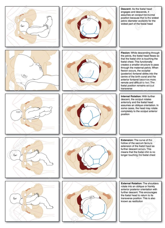 Birth of a child of childbirth scheme