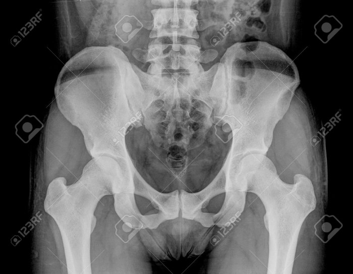 Big ASS Iskra Lawrence