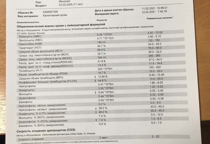 Rachel Cook in underwear