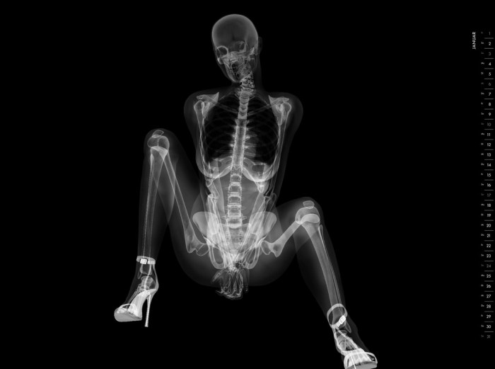 X -ray pictures of women