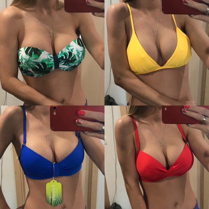 Mammoplasty before after