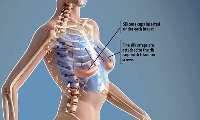 Silicone Breastplate