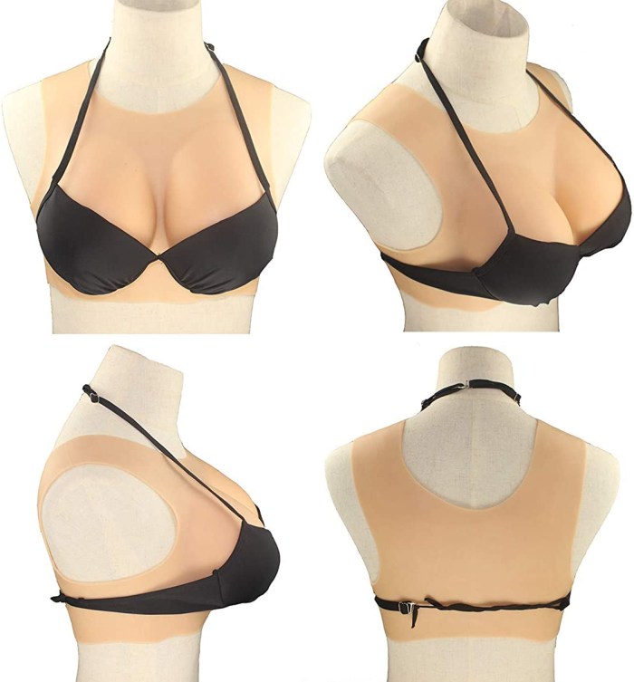 Macromastia of Grenny gigantomastia