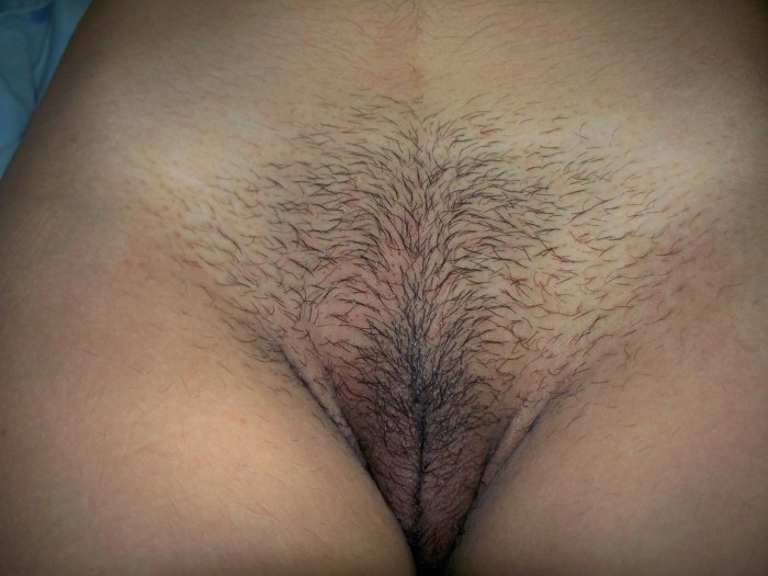 Long pubic hair
