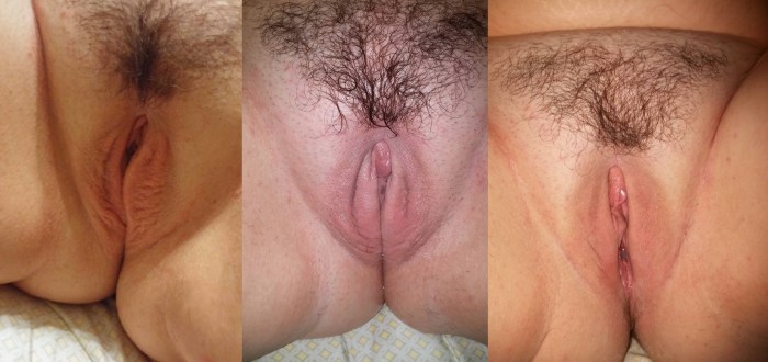 Dressed undressed collage girl vagina anus