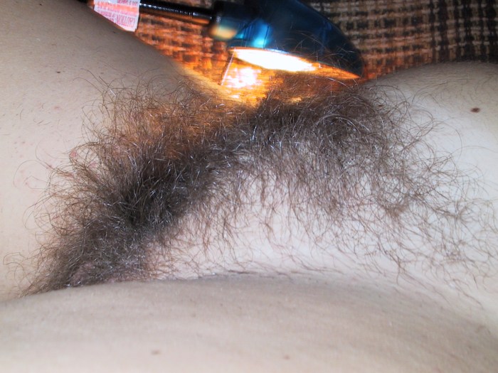 The most hairy female pubis
