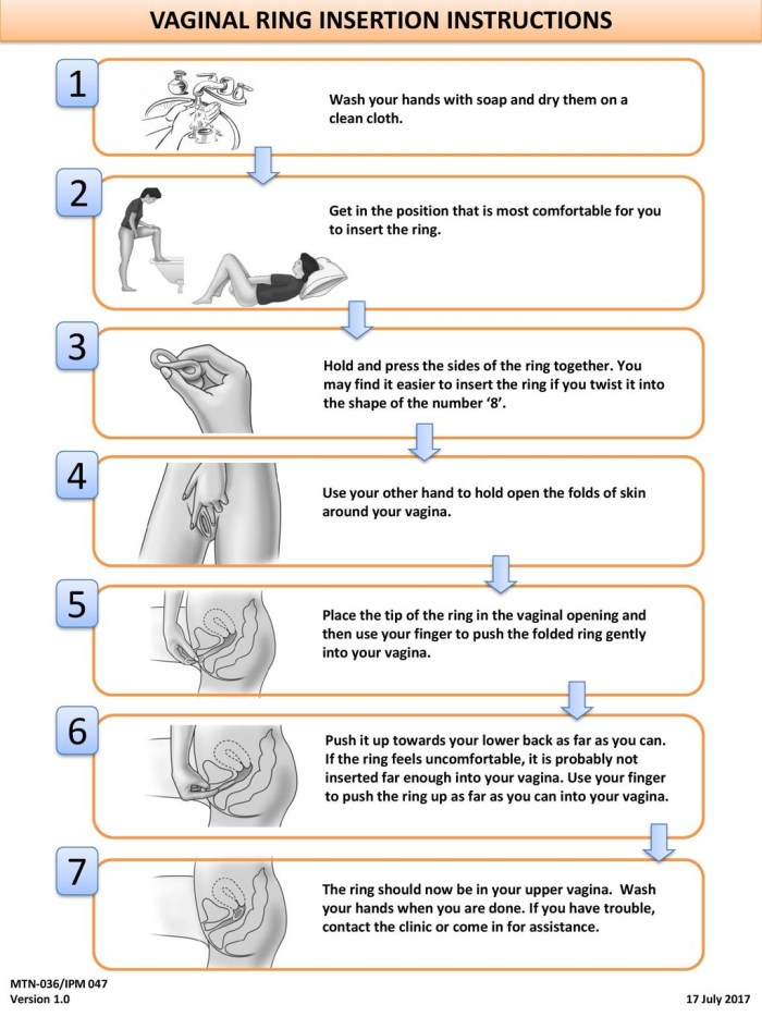 Types of vagina and their names