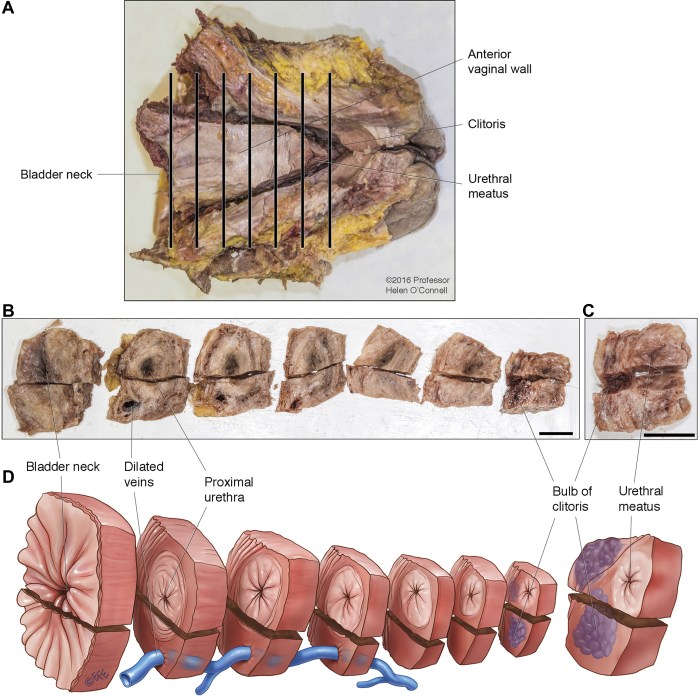Papillomatous vulvovaginitis