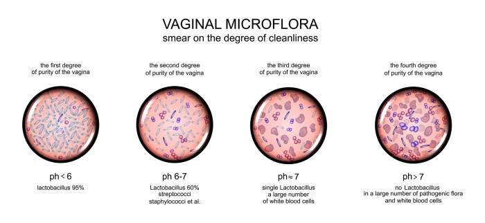 Vaginal microbia