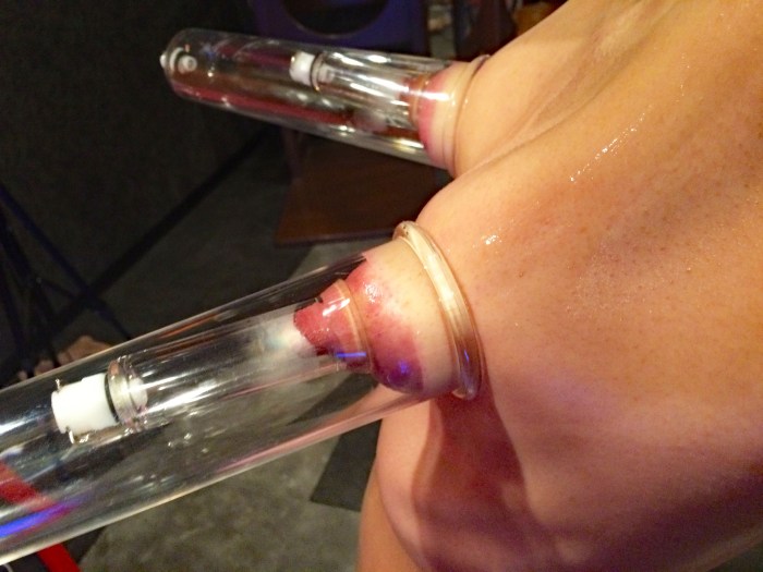 Vagina after a vacuum pump
