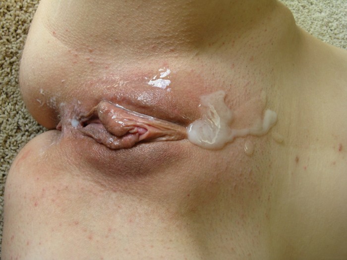 Ending from the vagina