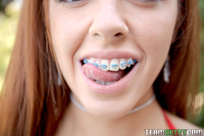 Porn actress blonde with braces