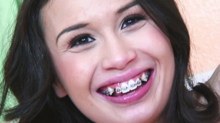 Cum Open Mouth Gag Blowjob Sex Pictures Pass