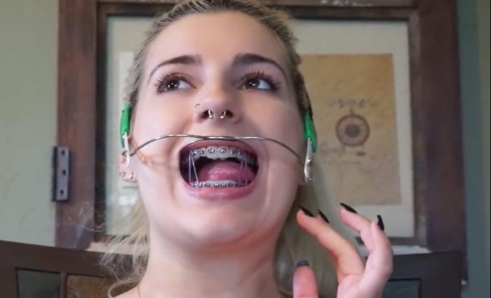 Pornstares with braces