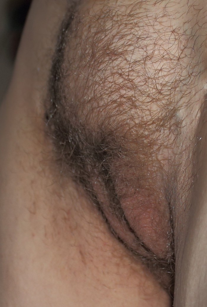Flush pubic hair