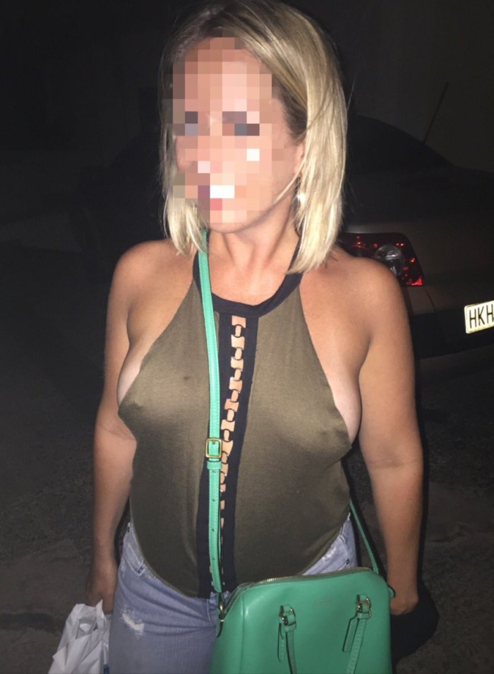 Sagging breasts with huge halo