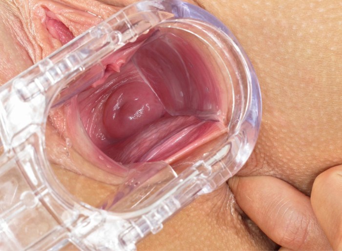 Tested walls of the vagina