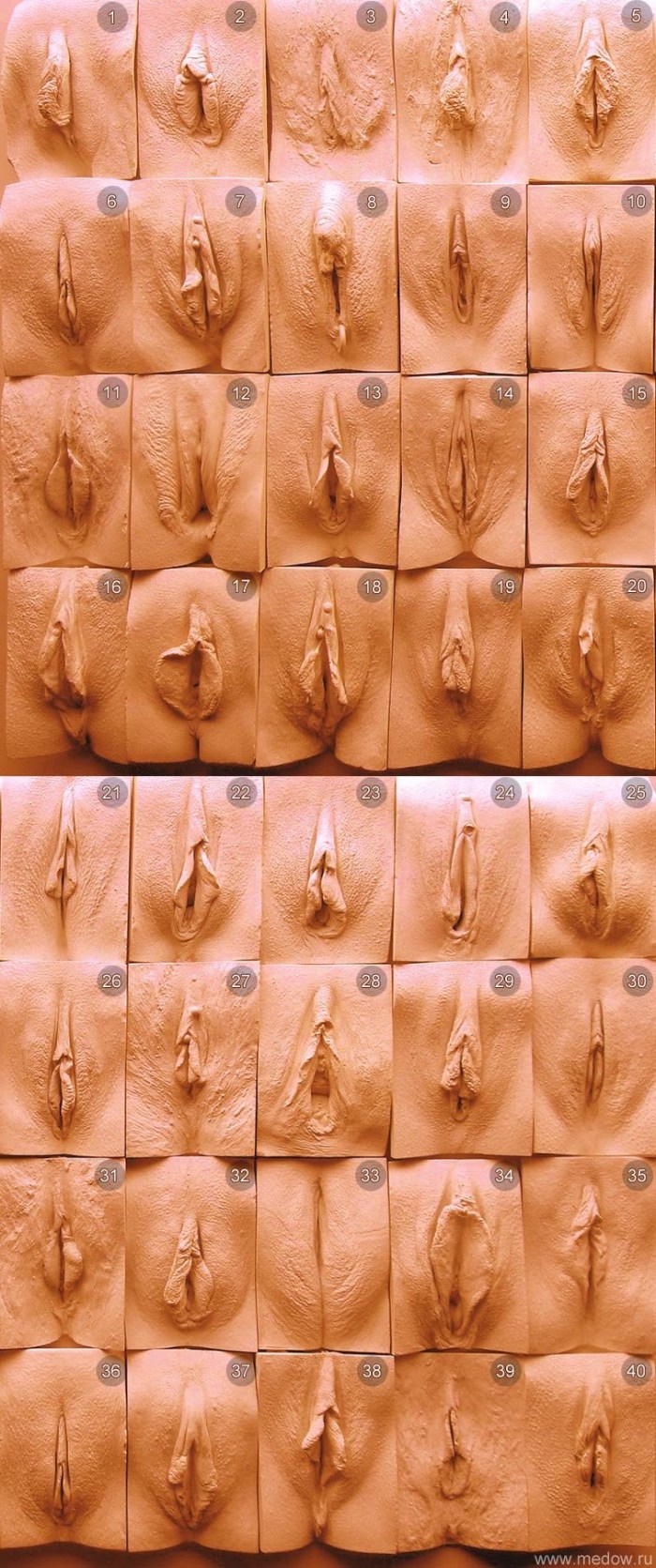 Varieties of female vaginas