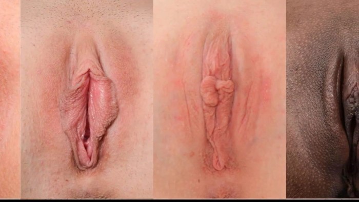 Forms of female vagina