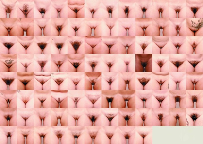Different forms of female genitals
