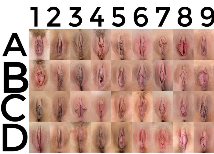 Varieties of women's vagina